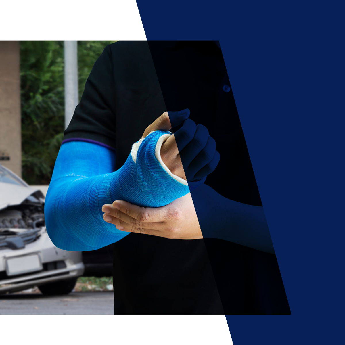 person with their arm and hand in a cast