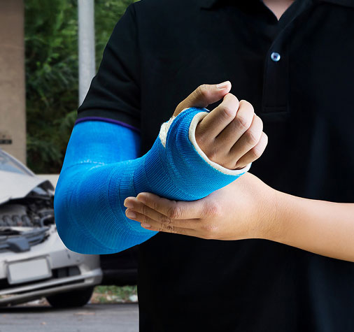 person with their arm and hand in a cast
